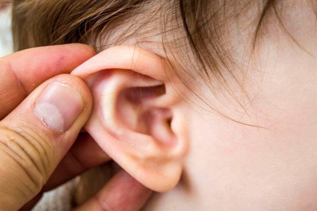 Các lưu ý khi chữa viêm tai giữa cần biết